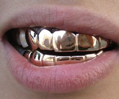 Category: Platinum Teeth - Royalgoldteeth